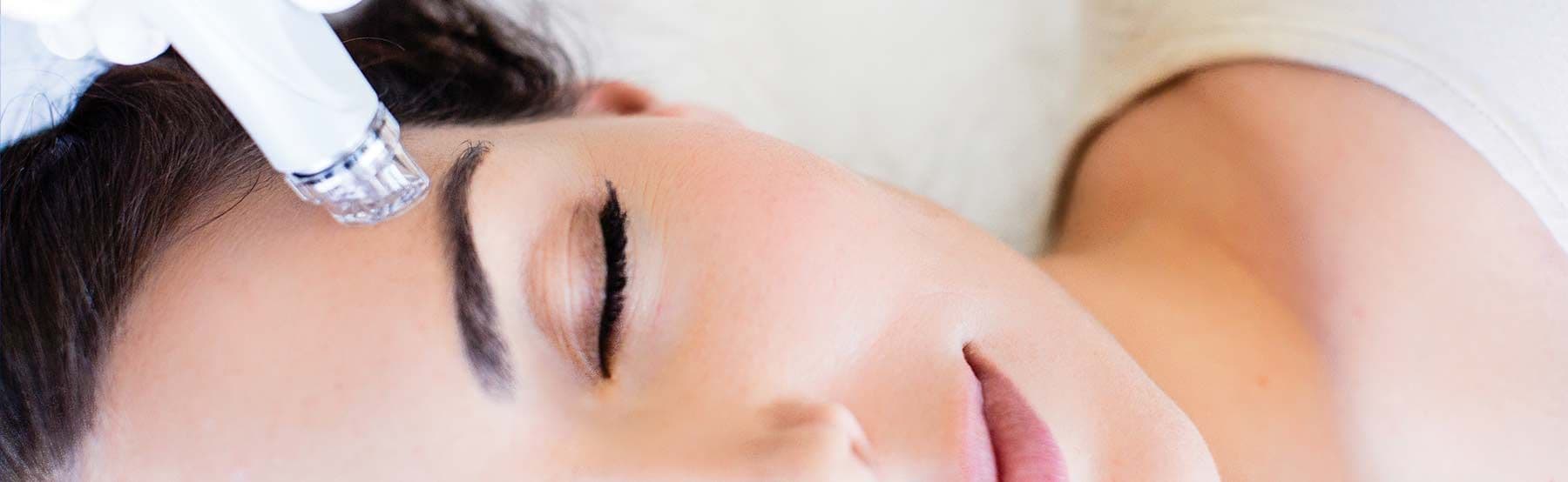 Hydrafacial Behandlung 2