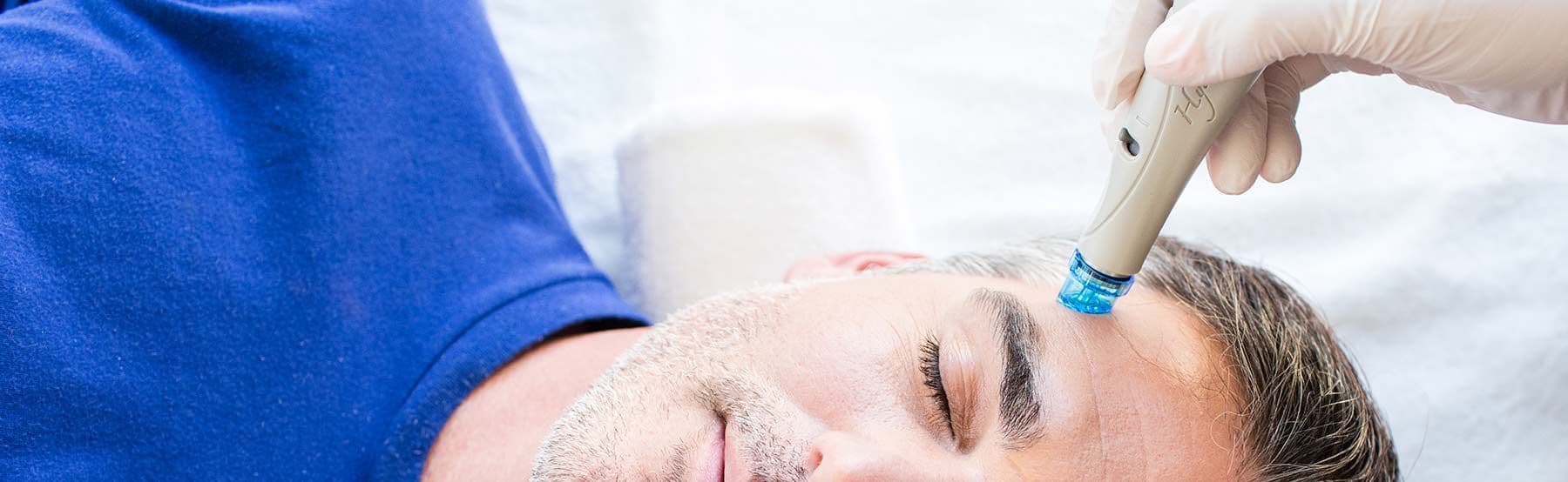 Hydrafacial Behandlung 3